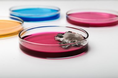 人腺病毒IgG(ADV-IgG)ELISA Kit試劑盒 人腺病毒IgG(ADV-IgG)ELISA Kit試劑盒