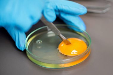 人萊姆IgG(Lyme-IgG)ELISA Kit試劑盒/測試盒