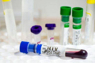 NADH氧化酶活性檢測試劑盒圖1