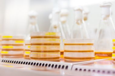 揮發性脂肪酸檢測在氣相色譜法中的應用圖1