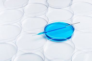 小鼠神經調節蛋白4(NRG-4)試劑盒 小鼠神經調節蛋白4(NRG-4)試劑盒