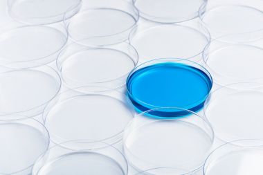 小鼠神經調節蛋白4(NRG-4)elisa試劑盒 小鼠神經調節蛋白4(NRG-4)elisa試劑盒