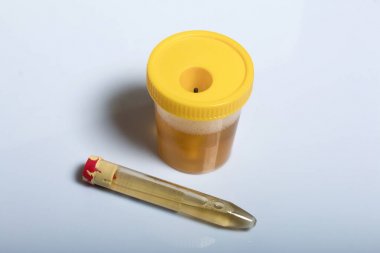 受體TNFRSF結(jié)合絲氨酸蘇氨酸激酶2(RIPK2)elisa試劑盒 受體TNFRSF結(jié)合絲氨酸蘇氨酸激酶2(RIPK2)elisa試劑盒