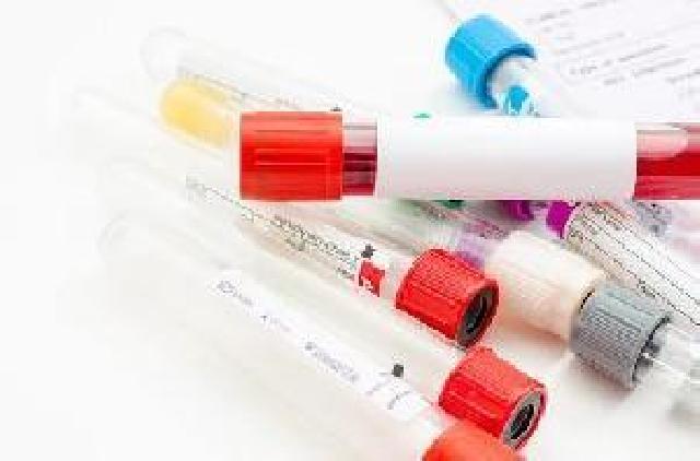 環磷酸鳥苷（cGMP）檢測